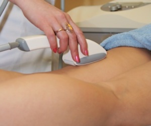 leg getting laser hair removal